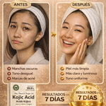 Kojibella Premium✨ - (2 PACK) Jabón despigmentante, antiacné y unificador del tono de la piel