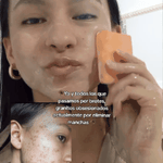 Kojibella Premium✨ - (2 PACK) Jabón despigmentante, antiacné y unificador del tono de la piel